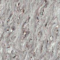 SHUBH INTERNATIONAL Nexus Spider - D 600 x 600 mm Grey Glossy Ceramic Tile_0